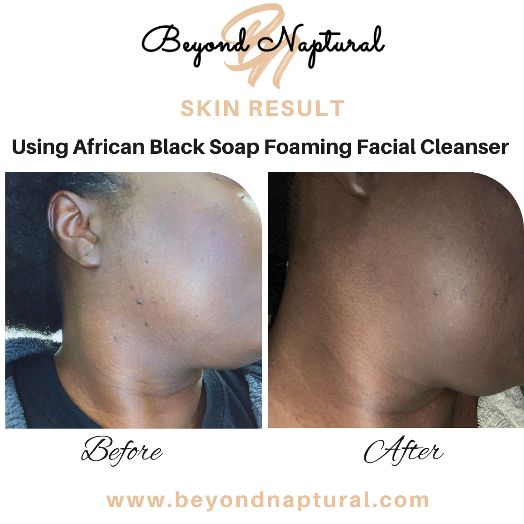 African Black Soap Foaming Facial Cleanser